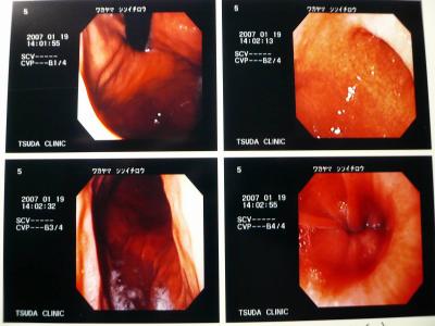 胃カメラでのぞく旅＠名古屋