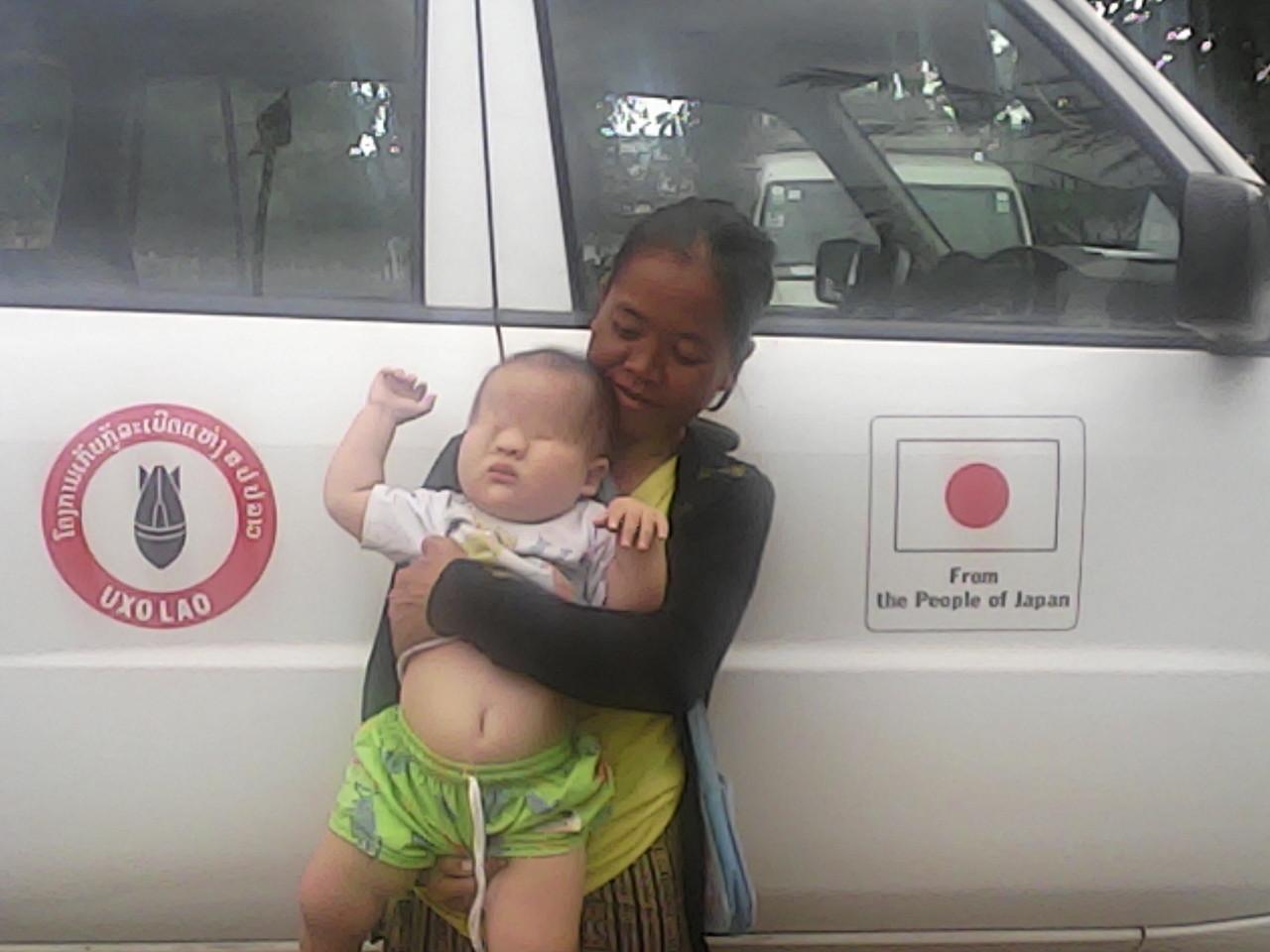 ラオス セコンの街のuxo ラオス政府の不発弾対策機関 に 目がのっぺらぼうの赤ちゃんが連れられてきた たぶん枯葉剤 ダイオキシンの被害者 何とか日本で医療を受けられないものか 12月5日 追記 Sfeという援助組織が見つかりました その他の都市