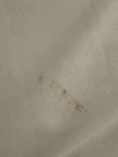 シーツの汚れを発見　　うーん困った。反対側を利用せねば