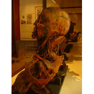 アルフォード獣医学校 フラゴナール博物館 Musee De Ecole Maisons Alfort By 迷子さん パリのクチコミ フォートラベル