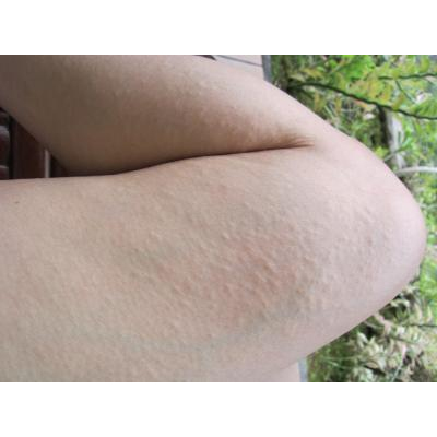 �����̿��ǥ��ߥޥ��󡣤֤Ĥ֤Ĥ������������ޤ�����