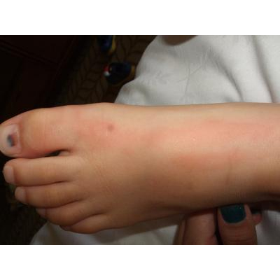 �֤��ھ��˺ٶݤ����ä��Ҷ���­