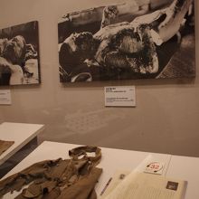 焼けてぼろぼろの衣服と壁には全身やけどで担ぎこまれた人。写真