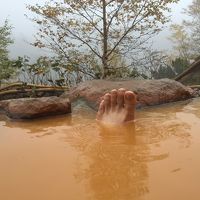 お見苦しい足ですが茶褐色の濃ゆさを見て欲しかったので投稿しま