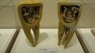 虫歯の復元模型もあります