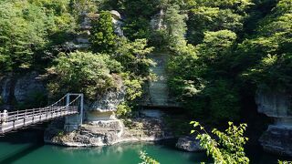 いつも窪んだところばかり見てしまう