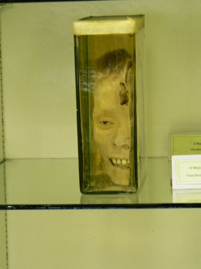 法医学（シーウィー）博物館の２つに割られた男の頭部のホルマリン漬け。