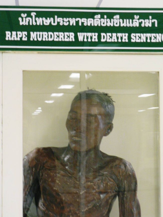 法医学（シーウィー）博物館の凶悪犯の死体標本。