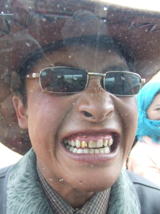 金歯を自慢してきました！！<br />