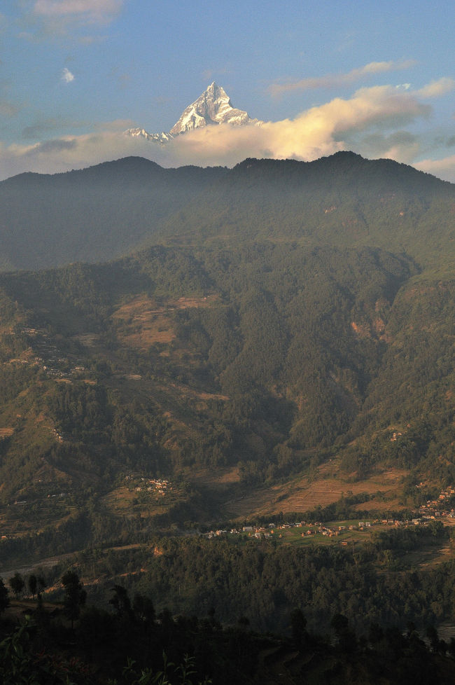 腰痛で揺られるよりもどんなにか楽です。