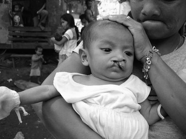 そこに1人の赤ちゃんがいた。。。<br />その赤ちゃんは口唇口蓋裂という障害があった。。。<br />日本でも数百人に1人の割合で必ず生まれてくる障害で、日本では早い段階で手術して開いてる唇を閉じるのだが、この赤ちゃんは手術してなかった・・・<br />手術しないと割れた唇から食べ物が出て栄養がとりにくく、赤ちゃんの成長にも影響が出てくる。。。<br />多分手術費の捻出ができないのだろう・・・<br />少し悲しい現実を見た感じがした。。。<br />そこの人たちも生まれてからずっとごみと共に暮らしているのたろう。。。<br />インドのカーストの低い人たちもそうだが、絶対にその生活からは抜け出せない・・・<br />その部落で暮らし、その部落で仕事をして、その部落の人と結婚する。。。<br />それはその人たちではどうしようもない運命みたいなもので変われない・・・<br />アメリカの新大統領は「チェンジ」とスローガンをあげているが、変わりたくても絶対に変わることのできない人々がそこには大勢いた。。。