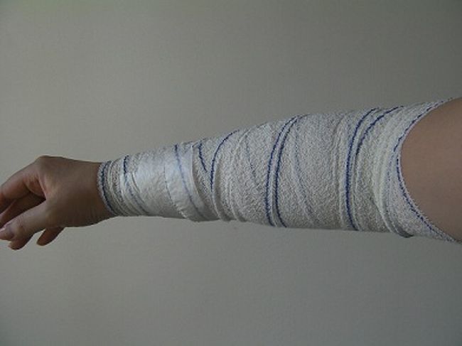 病院では日本人医師、三村先生が診察してくださいました。<br />やさしくて、とても親切な先生でした。<br />で、腕はこんな感じに。