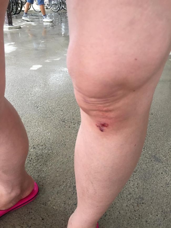 家にいると自動車で移動するのが当たり前になってしまった私たち。<br />電動自転車ですが、雨で地面がぬかるんでいる。　<br />自転車操作ができず、そのまま倒れる姿を目の当たりで見ていた私は大笑い。<br />すまん^_^;　<br />友人は、膝っこぞうから流血　（≧∇≦）