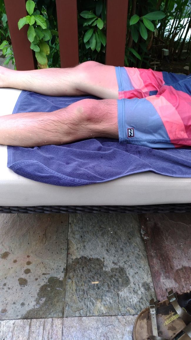 お見苦しい！<br />兎に角暑いのでもプールに入る度に日焼け止め塗らなきゃダメ！