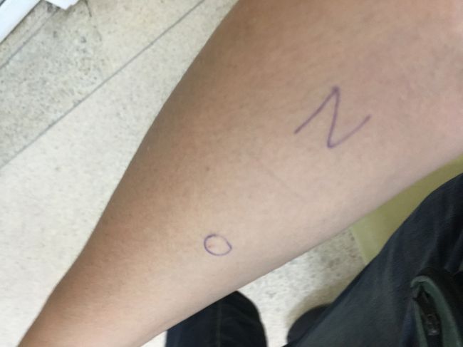 両腕に皮下注射。あ、こんなに簡単なんだ・・・と思ったら、これはアレルギーテストであったよう。