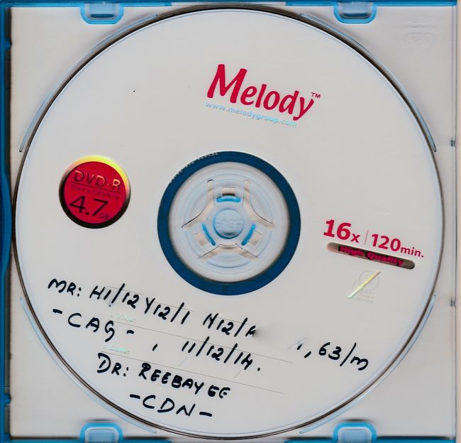 ポートルイスにある病院で心臓冠動脈のMRI画像のCD