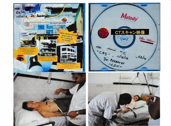 日本に帰国して、葉山ハートセンターで精密検査して<br />その後心臓のアブレーション手術<br />心肺停止から日本での手術までの全ての医療費５００万円<br />海外旅行保険に加入していないが、出発前に家の近くに<br />ホームセンターができカード作成の勧誘で作ったカードの<br />付帯保険でその殆どが支払われた。<br />保険料はゼロ円