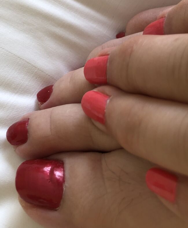 　お見苦しく失礼<br />ホイアンのスパ　ＭＩＭＯＳＡにて　<br />甘皮処理で強く押され、出血。マッサージは撫でられる感じで、力不足、残念。<br />